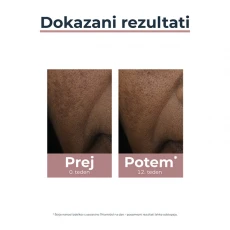 Eucerin Anti-Pigment korektor, 5 ml