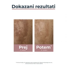 Eucerin Anti-Pigment dvojni serum, 30 ml